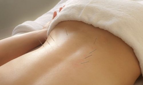 Acupuncture for pain - Alternative Medicine solutions!